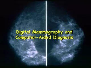 Digital Mammography and Computer-Aided Diagnosis