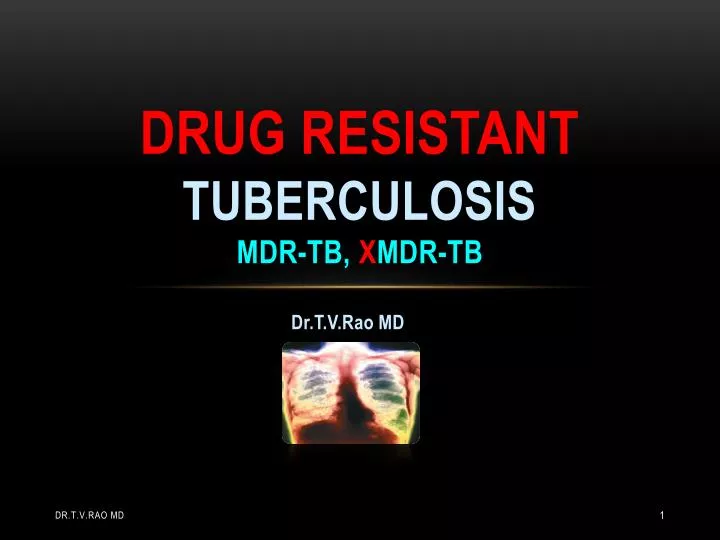 drug resistant tuberculosis mdr tb x mdr tb