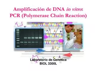 Amplificación de DNA in vitro : PCR (Polymerase Chain Reaction)