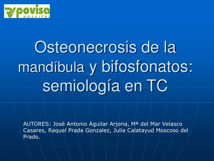osteonecrosis de la mand bula y bifosfonatos semiolog a en tc