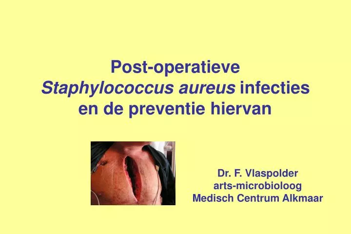 post operatieve staphylococcus aureus infecties en de preventie hiervan