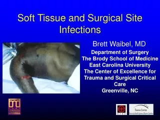 Soft Tissue and Surgical Site Infections