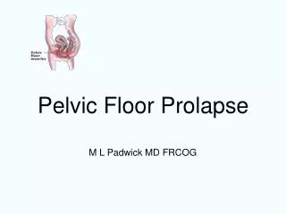 Pelvic Floor Prolapse