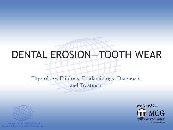 dental erosion tooth wear