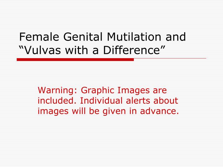 female genital mutilation and vulvas with a difference