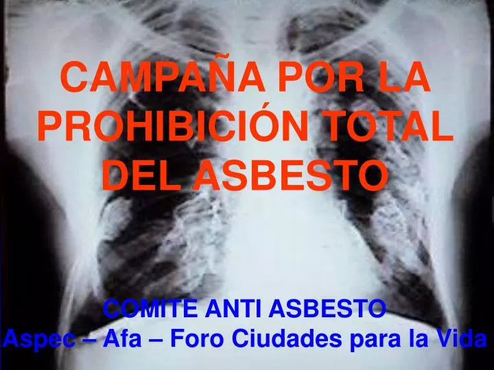los peligros del asbesto los peligros del asbesto para la salud humana para la salud humana