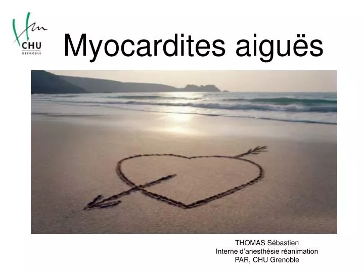 myocardites aigu s