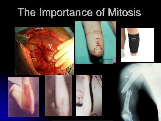 The Importance of Mitosis