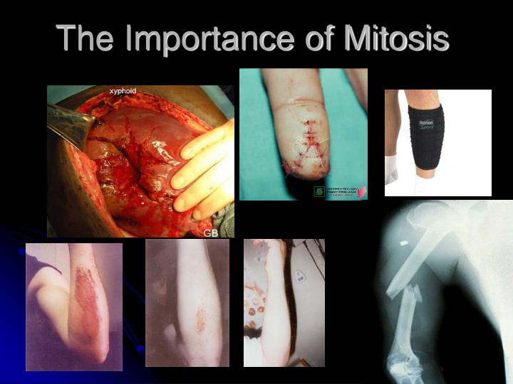 the importance of mitosis