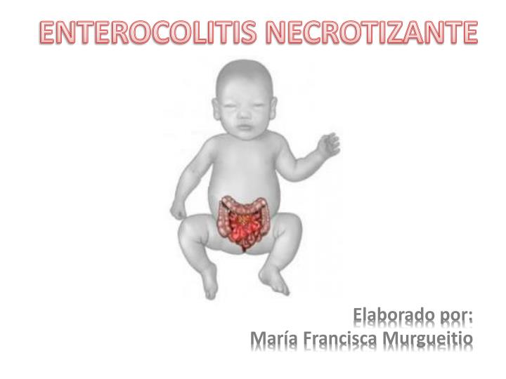 enterocolitis necrotizante