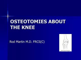 OSTEOTOMIES ABOUT THE KNEE