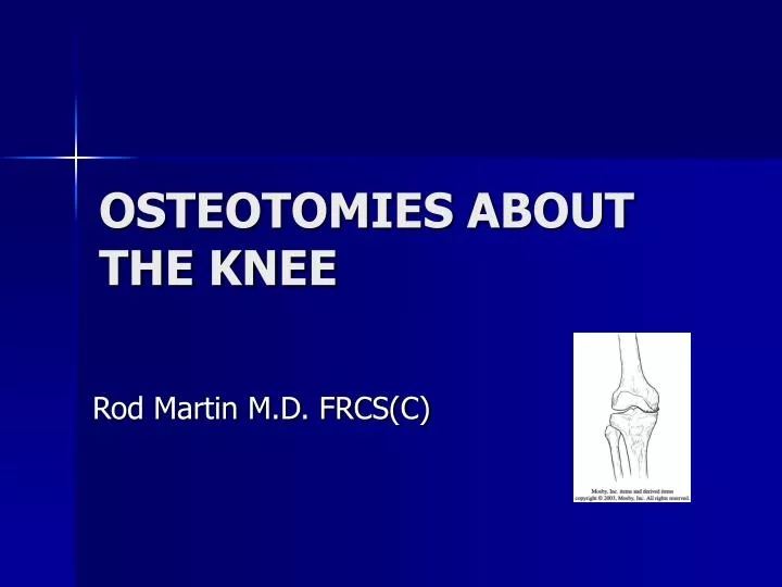 osteotomies about the knee