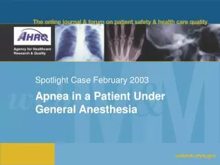 Spotlight Case February 2003