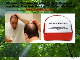 Stopping Hair Loss for male pattern baldness