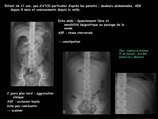 Enfant de 11 ans, pas d’ATCD particulier d’après les parents ; douleurs abdominales, AEG depuis 8 mois et vomissements d