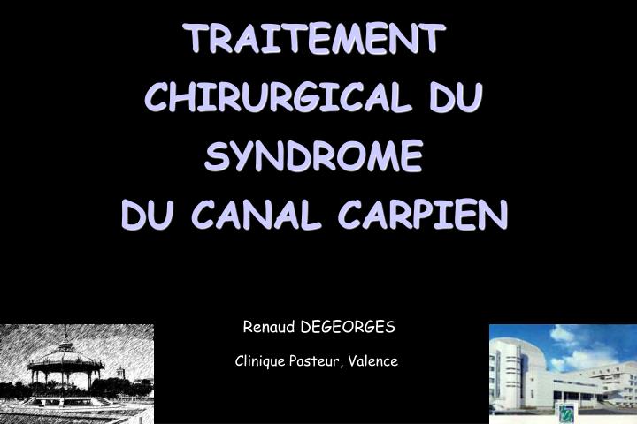 traitement chirurgical du syndrome du canal carpien