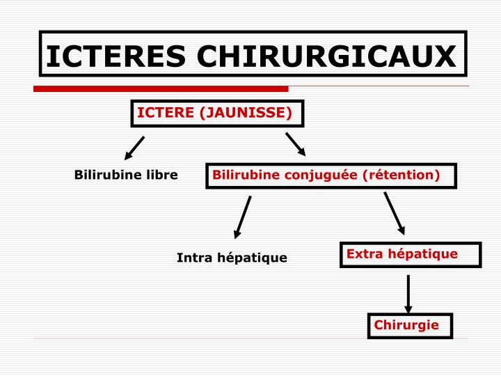 icteres chirurgicaux