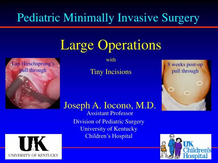 pediatric minimally invasive surgery