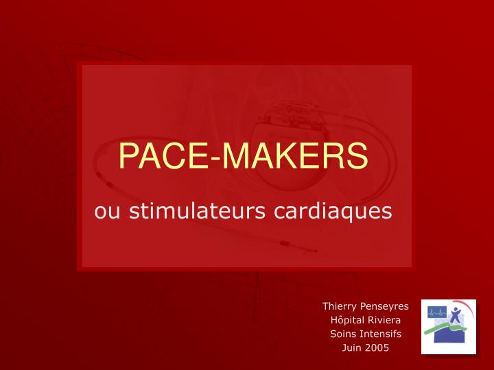 pace makers