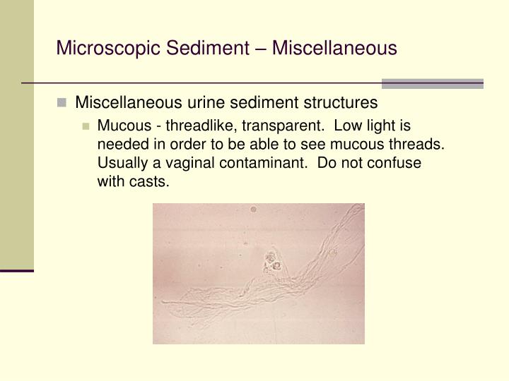 microscopic sediment miscellaneous
