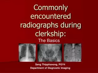 Commonly encountered radiographs during clerkship: