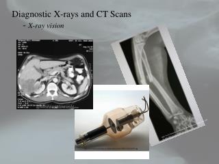 Diagnostic X-rays and CT Scans 	- X-ray vision