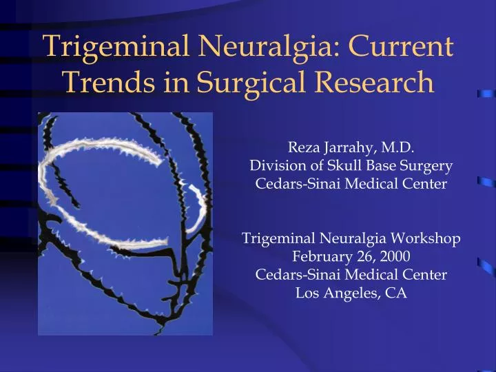 trigeminal neuralgia current trends in surgical research