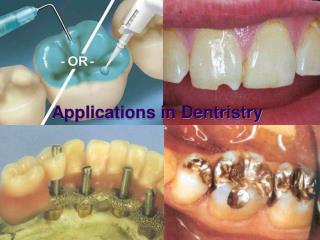 Applications in Dentristry