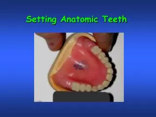 Setting Anatomic Teeth