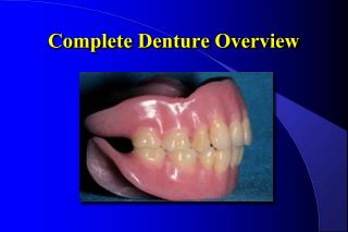 Complete Denture Overview
