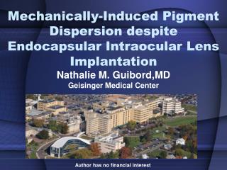 Mechanically-Induced Pigment Dispersion despite Endocapsular Intraocular Lens Implantation