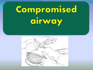 Compromised airway