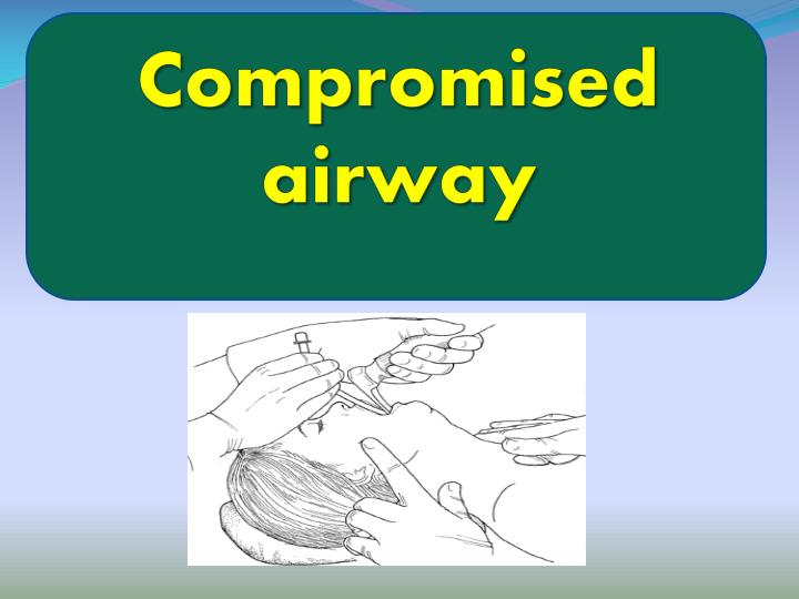 compromised airway