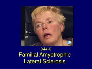 Familial Amyotrophic Lateral Sclerosis