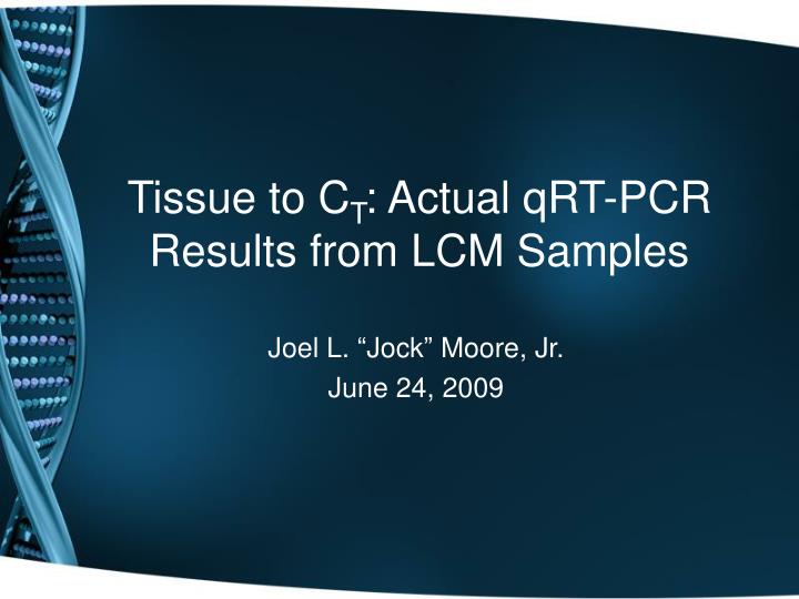 tissue to c t actual qrt pcr results from lcm samples