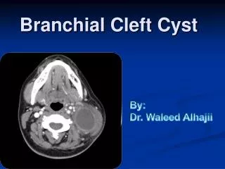Branchial Cleft Cyst