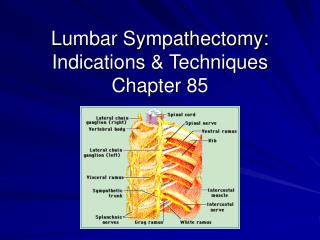 Lumbar Sympathectomy: Indications &amp; Techniques Chapter 85