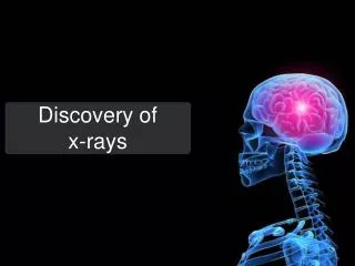 Discovery of x-rays