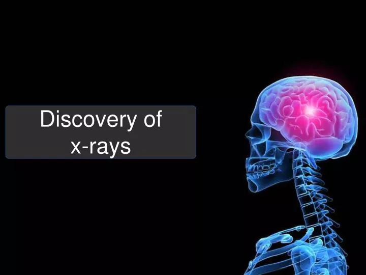 discovery of x rays