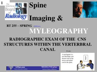 Spine Imaging &amp; MYLEOGRAPHY