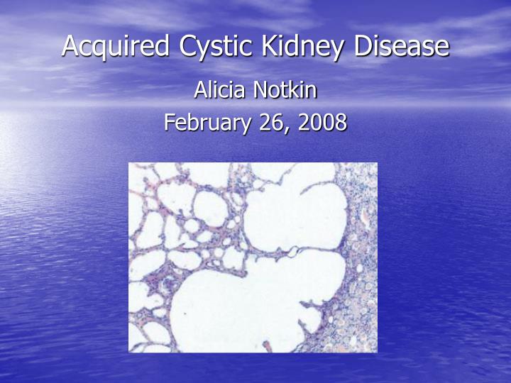 acquired cystic kidney disease