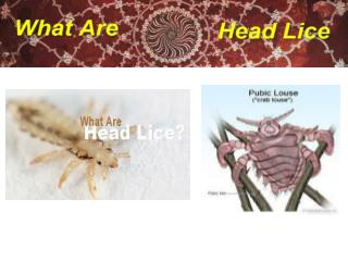 What Are Head Lice