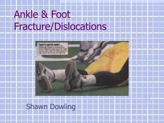 Ankle &amp; Foot Fracture/Dislocations