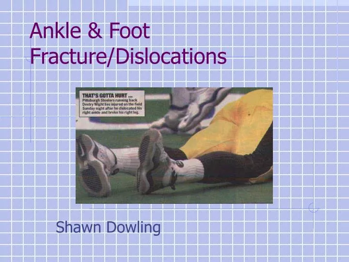 ankle foot fracture dislocations