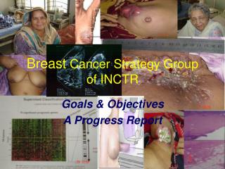 Breast Cancer Strategy Group of INCTR