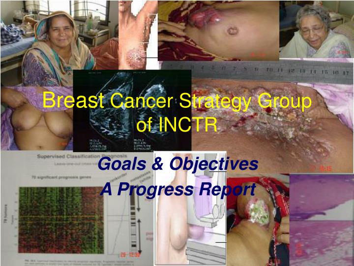 breast cancer strategy group of inctr