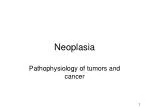Neoplasia - slide 1