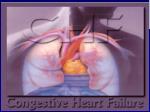 Drugs for CCF - slide 1