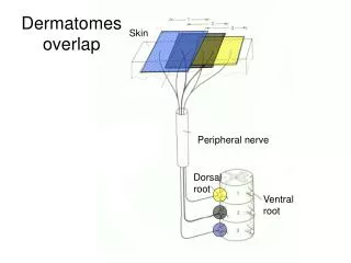 Dermatomes overlap