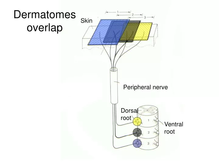 dermatomes overlap